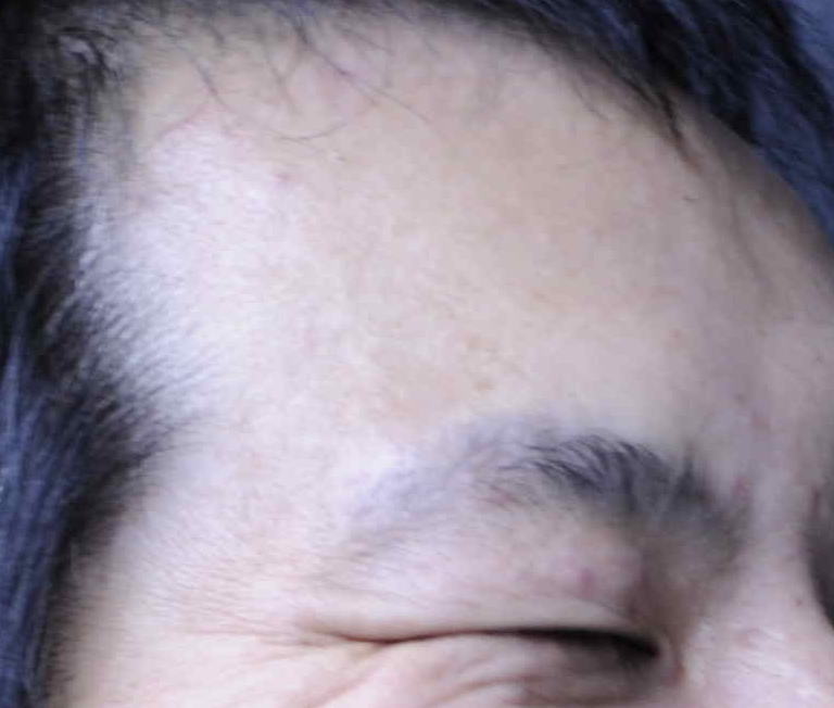 �u���摜�v